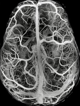 Brain Reprogramming 101: How to Gently Rewire Your Mind for Manifestation